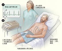 冠心病需要做哪些檢查？