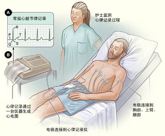 冠心病需要做哪些檢查？(圖1)